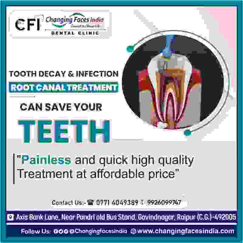 Best Prosthodontist Consultant in Raipur - Dr. Neeraj Chandraker - Raipur