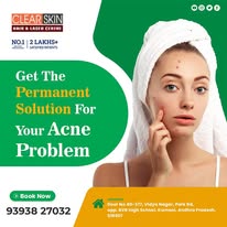 Best Acne Scar Laser Treatment  In India - Hyderabad