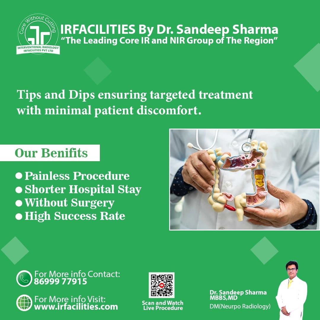 TIPS Procedure: Minimally Invasive Treatment for Portal Hypertension  - Chandigarh