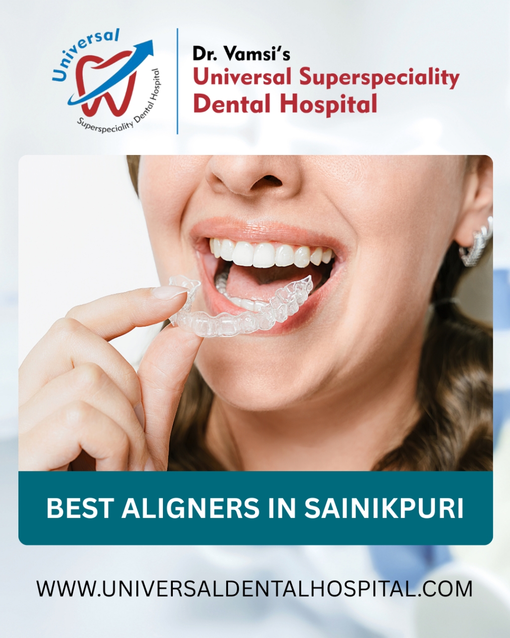 Unveiling Your Perfect Smile: A Guide to the Best Aligners in Sainikpuri - Hyderabad Unveiling Your Perfect Smile: A Guide to the Best Aligners in Sainikpuri - Hyderabad