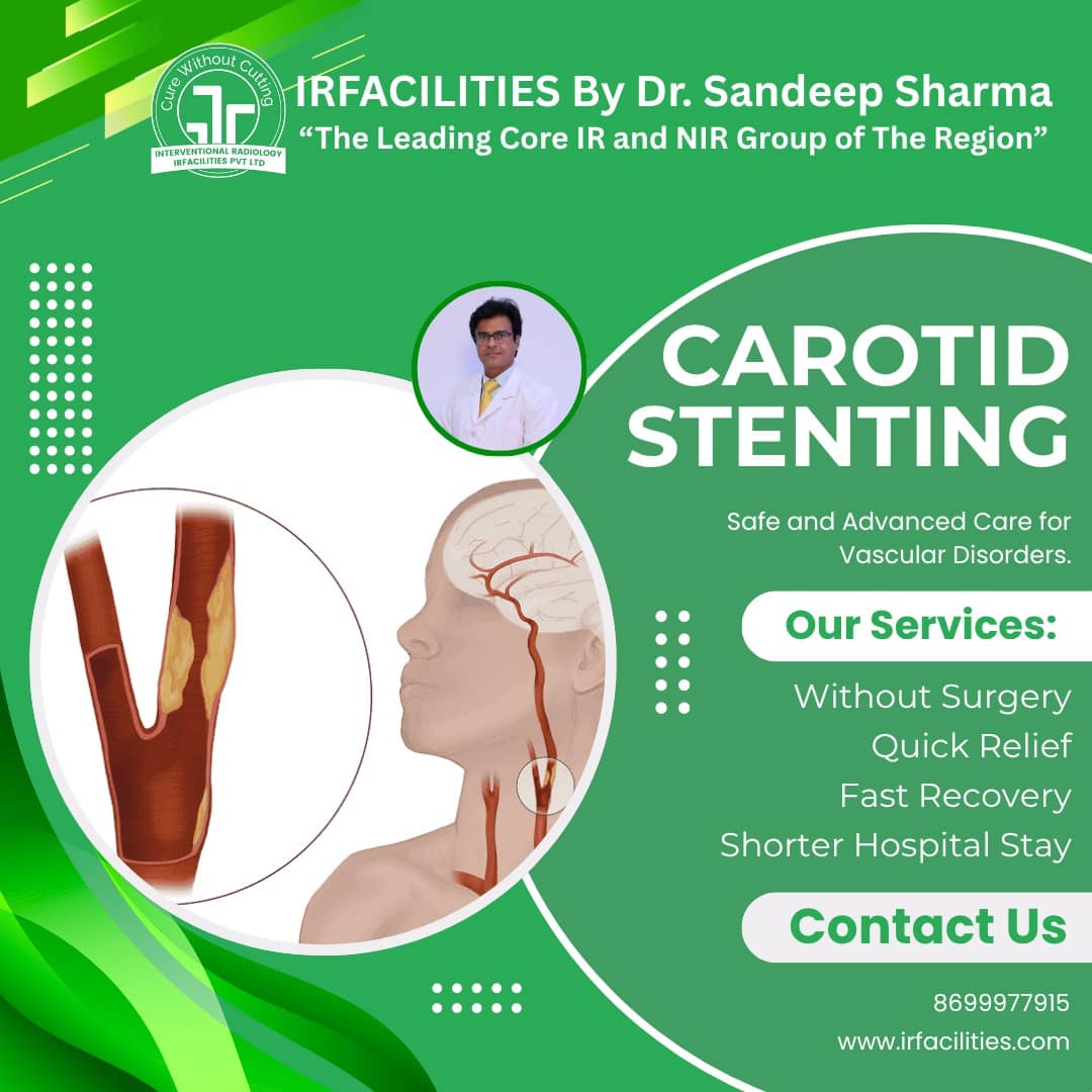 ICA Stent | Best Stent for Treatment of Internal Carotid Artery Stenosis - Mohali