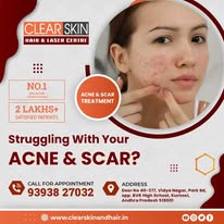 Hair Transplant Treatment in india - Hyderabad