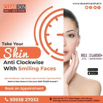 best vbeam laser treatment in india - Hyderabad