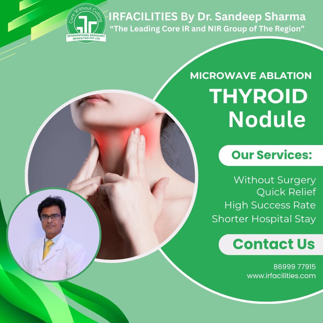  Treatment for Thyroid Nodule Without Surgery in India - Chandigarh