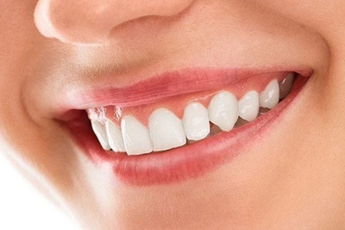 Dental Smile Makeover in Indore Dr Atul Jajoo - Indore