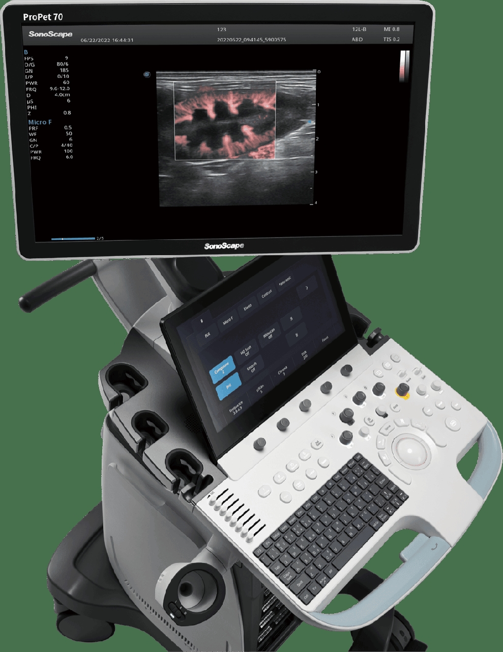 Portable Ultrasound Machine | SonoScape - Delhi