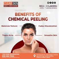 Best Acne Scar Laser Treatment in India - Hyderabad