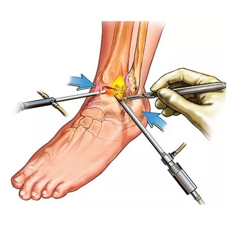 Arthroscopy Surgeon - Delhi